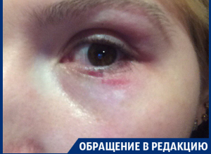В Воронеже директор «Магнита» избила девушку, заступившуюся за мать В Воронеже директор «Магнита» избила девушку, заступившуюся за мать