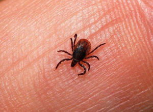 В Воронежской области 48 человек были укушены заразными клещами В Воронежской области 48 человек были укушены заразными клещами
