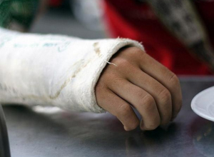 Воронежский детский сад заплатит родителям 6-летней девочки за сломанную руку Воронежский детский сад заплатит родителям 6-летней девочки за сломанную руку
