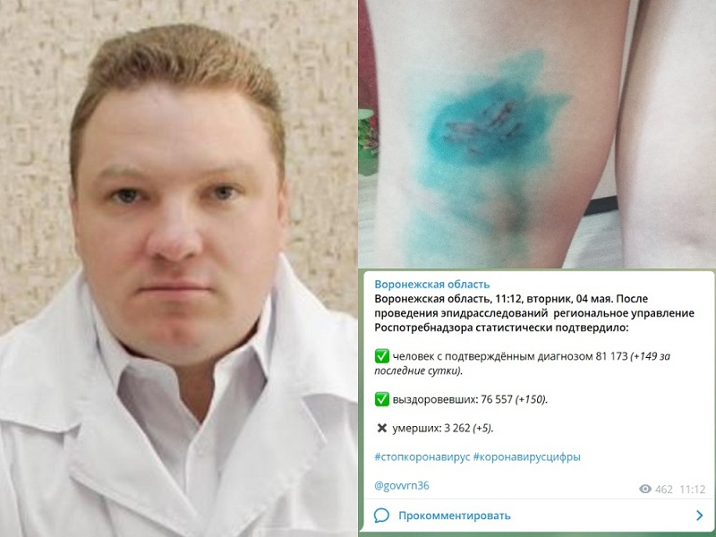 Коронавирус в Воронеже 4 мая: +150 зараженных, 5 смертей и укус бездомной собаки Коронавирус в Воронеже 4 мая: +150 зараженных, 5 смертей и укус бездомной собаки